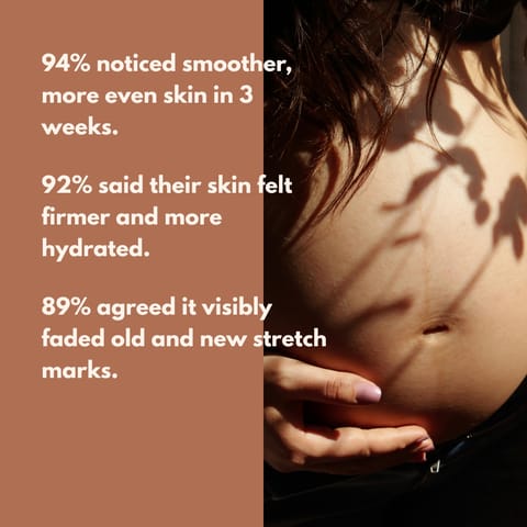 GLO Mama Stretch Mark Oil Roll-On for Pregnancy | Prevents & Reduces Stretch Marks | Doctor-Formulated, Safe for Moms-to-Be